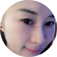 王靖菲