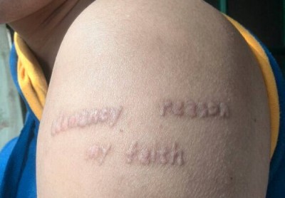 广药三院疤痕科