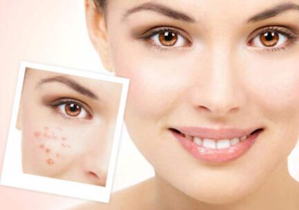 广州疤痕整形医院